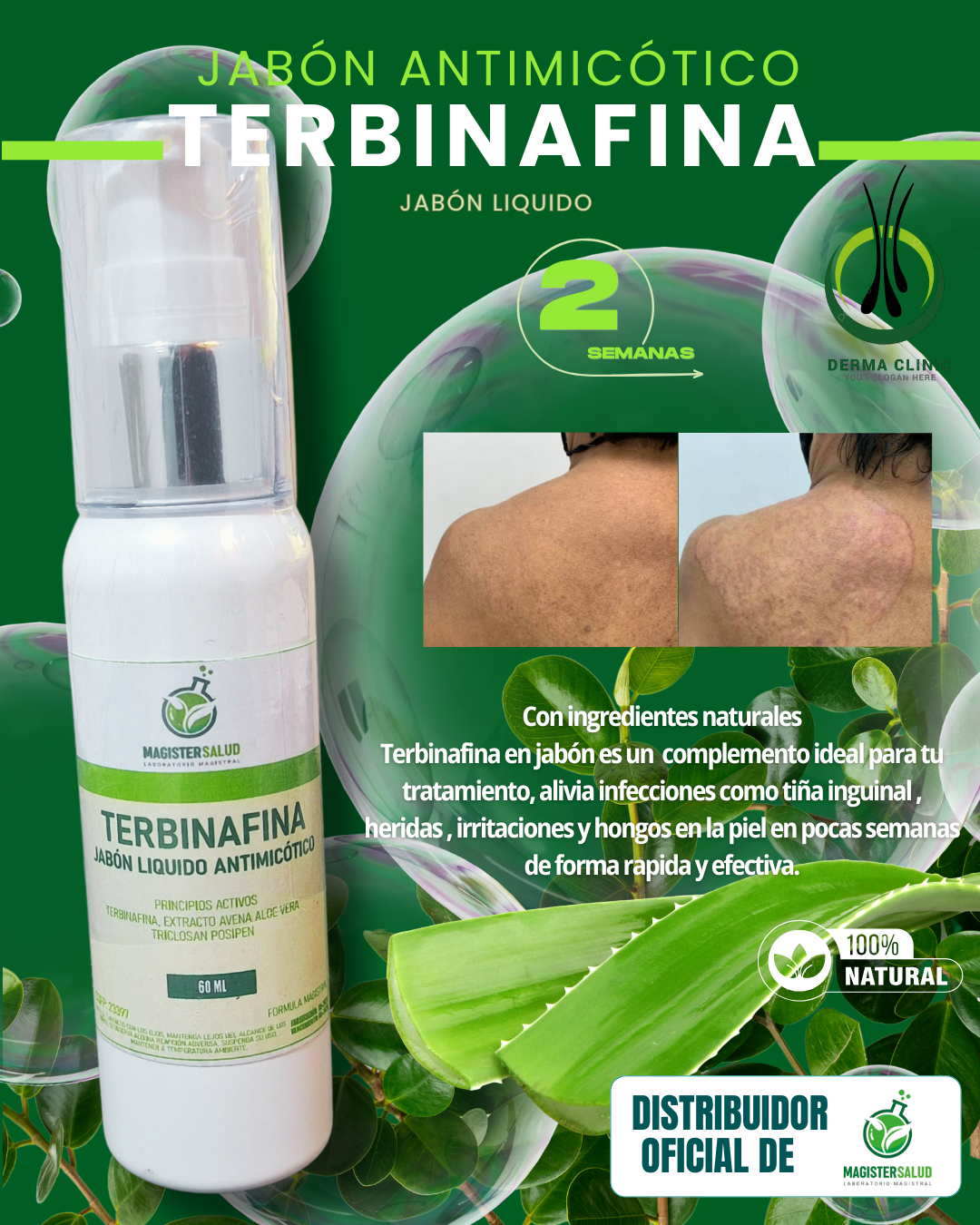 JABON LIQUIDO TERBINAFINA